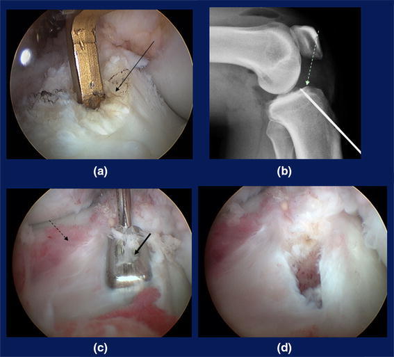 Fig. 9