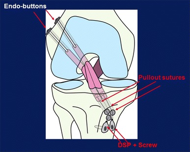 Fig. 13