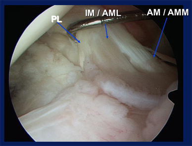 Fig. 12