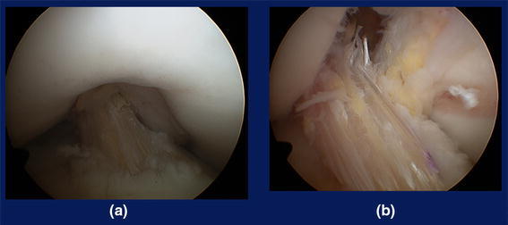 Fig. 10