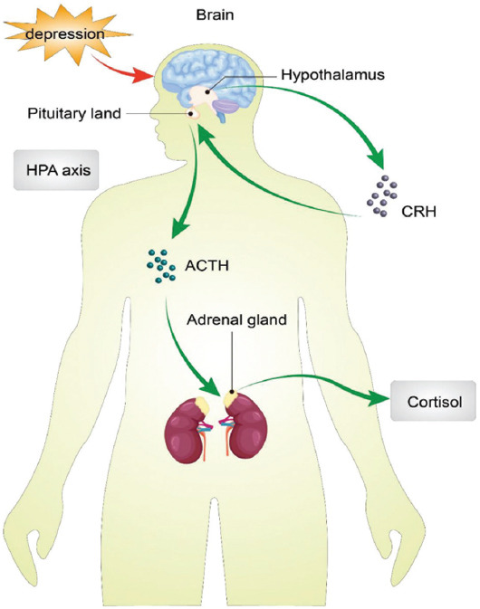 FIGURE 1