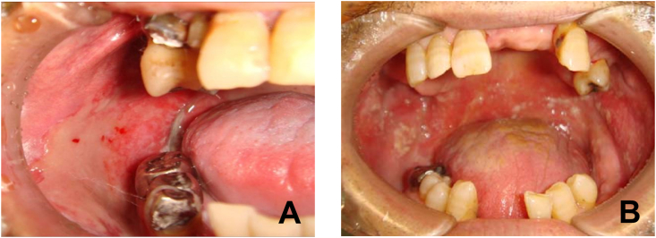 Figure 2