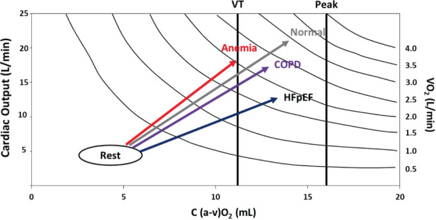 EJHF-2601-FIG-0001-c