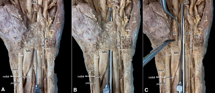 Fig. 4