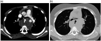 Fig. 12.