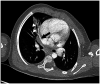 Fig. 14.