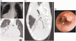 Fig. 10.