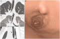 Fig. 11.