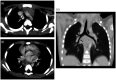 Fig. 13.