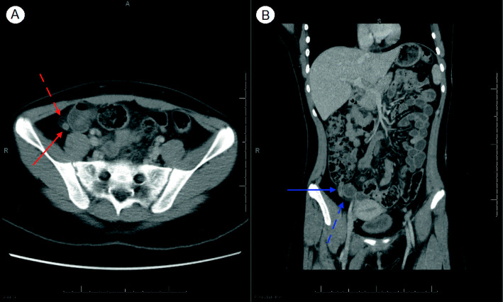 Fig. 1