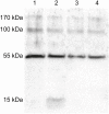 Fig 11