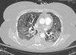 Fig. 5