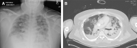 Fig. 4