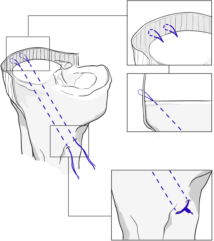 Fig 5