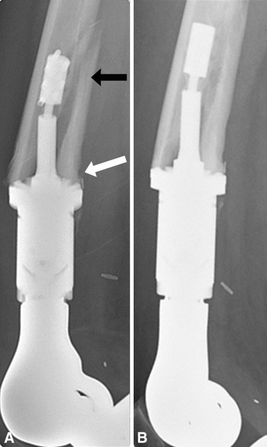 Fig. 7A–B