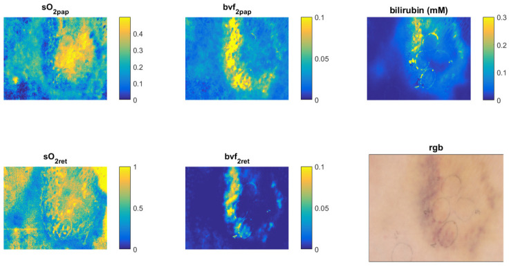 Figure 14