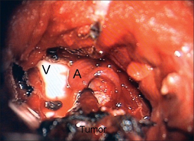 Figure 2f