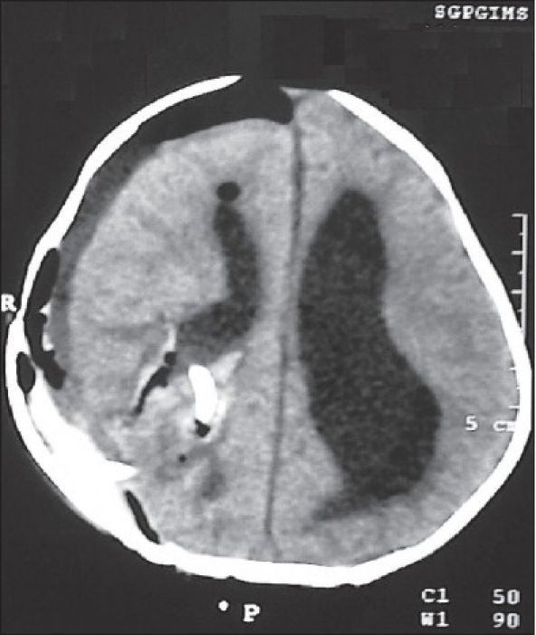 Figure 3e