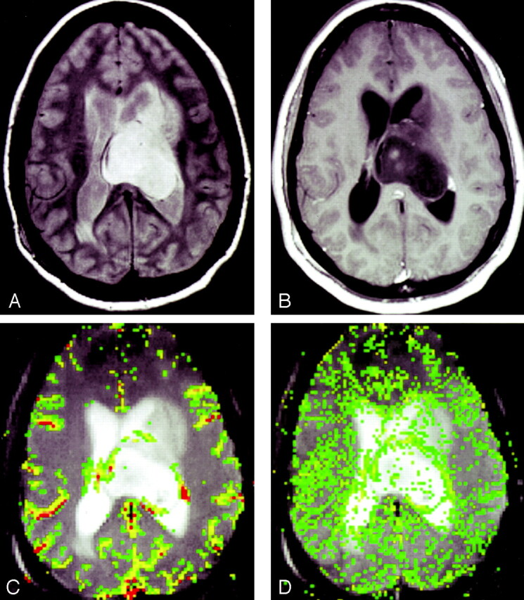 Fig 3.