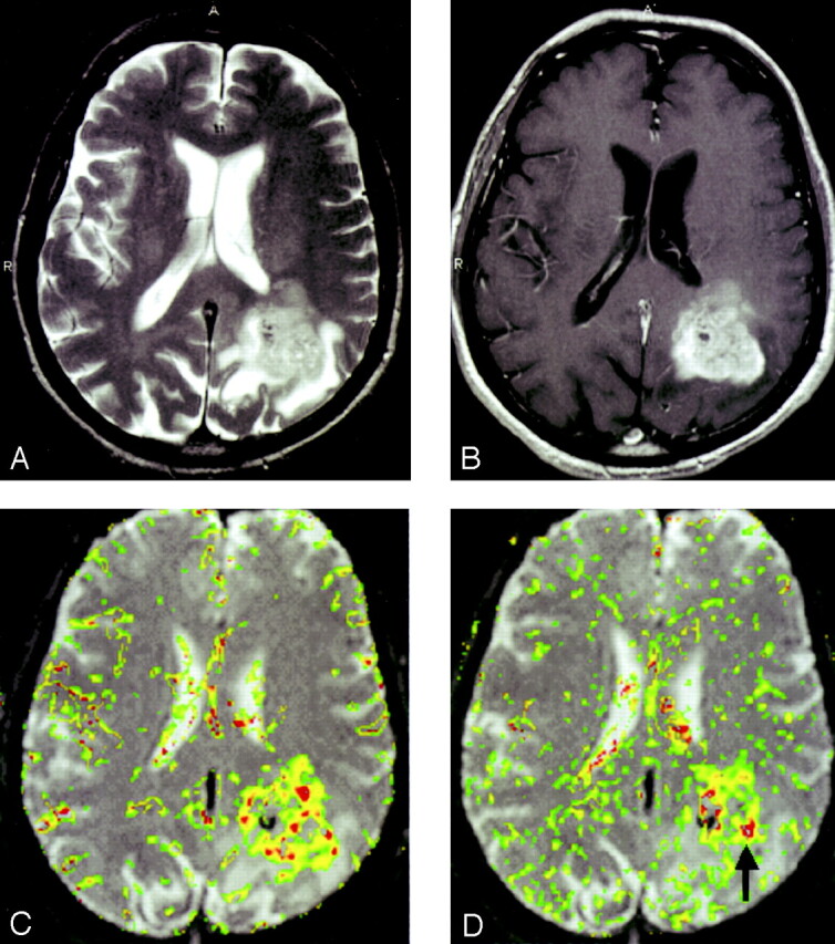 Fig 4.