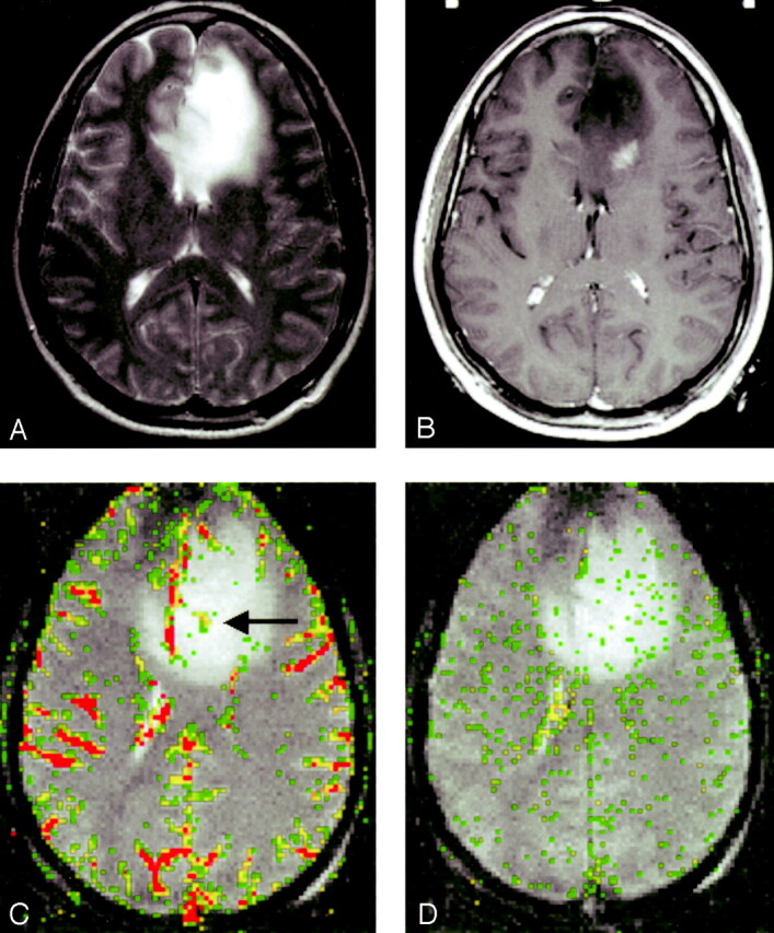 Fig 2.