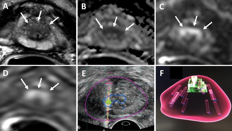 Figure 2: