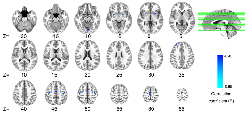 Fig.4.