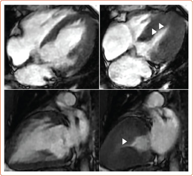 Figure 2: