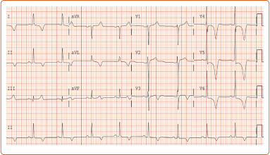 Figure 1: