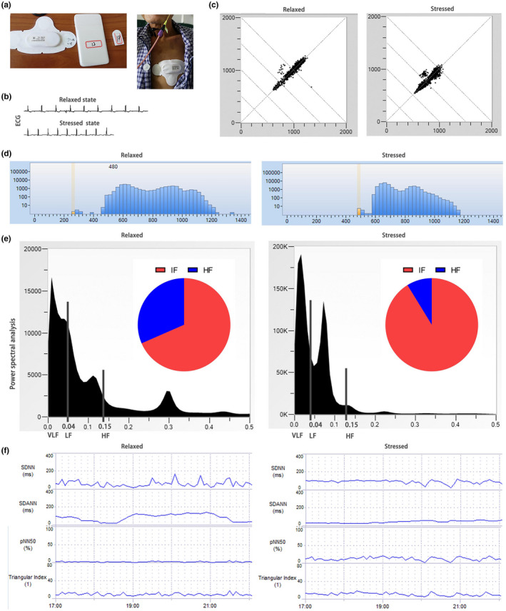 FIGURE 1