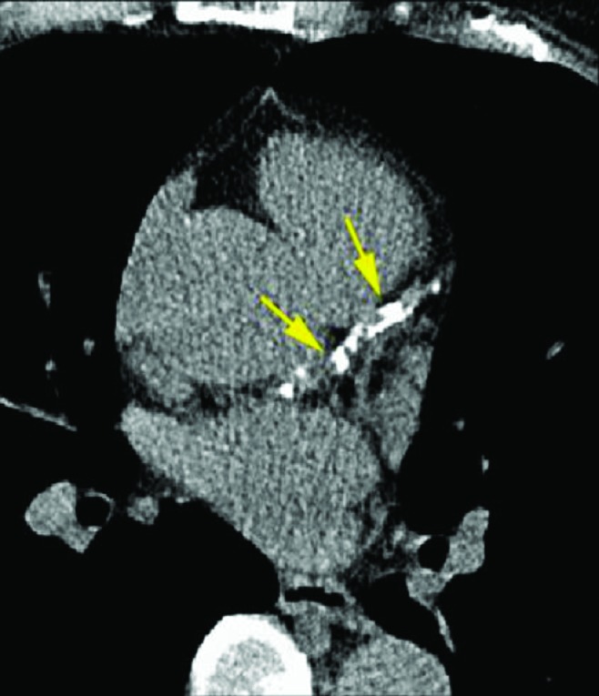 FIG. 2.