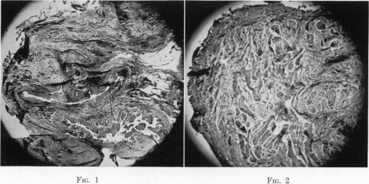 Fig. 1., Fig. 2.