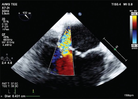 Figure 4