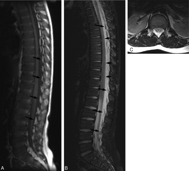 Fig 3.