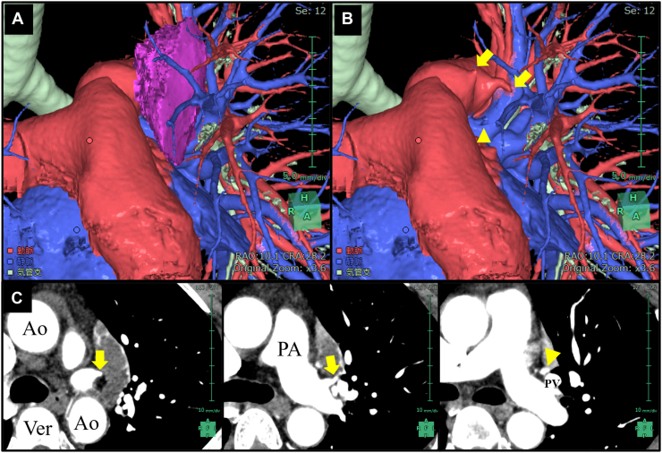 Figure 3