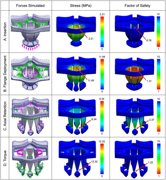 FEA of PeriPath demonstrating forces simulated, stress, and factor of safety under (a) insertion forces, (b) flange deployment forces, (c) axial retention forces, and (d) torque. Fixtures are indicated by blunted arrows, whereas external forces are indicated by long arrows. Maximum stress and minimum factor of safety are labeled.