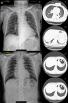 Fig 4