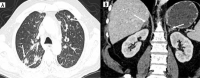 Fig. 14
