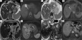 Fig. 11