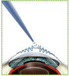 Fig. 13