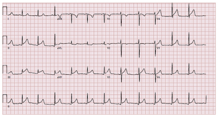 Fig. 4