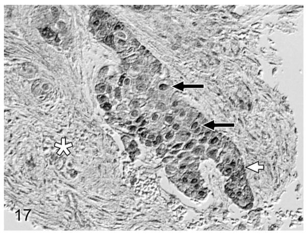 Figure 17