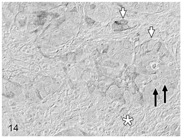 Figure 14