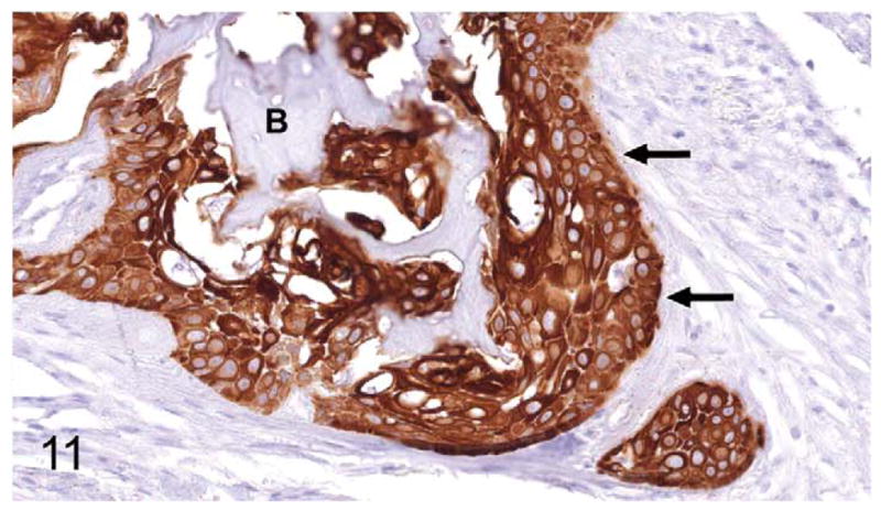 Figure 11