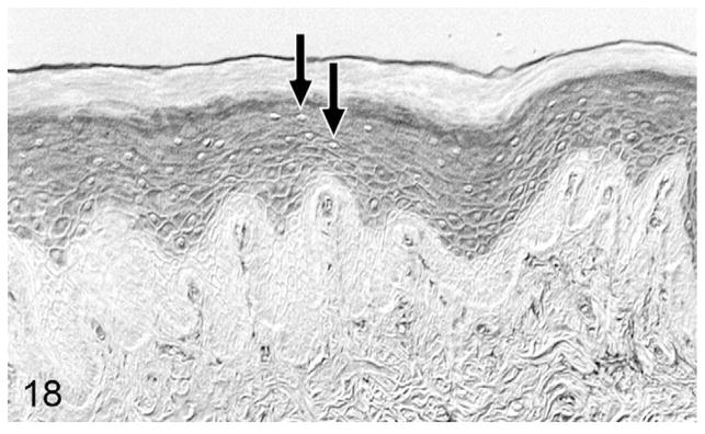 Figure 18