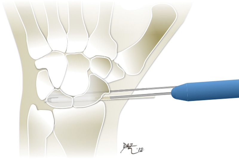 Fig. 8