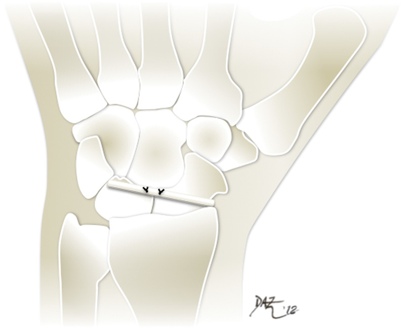 Fig. 10