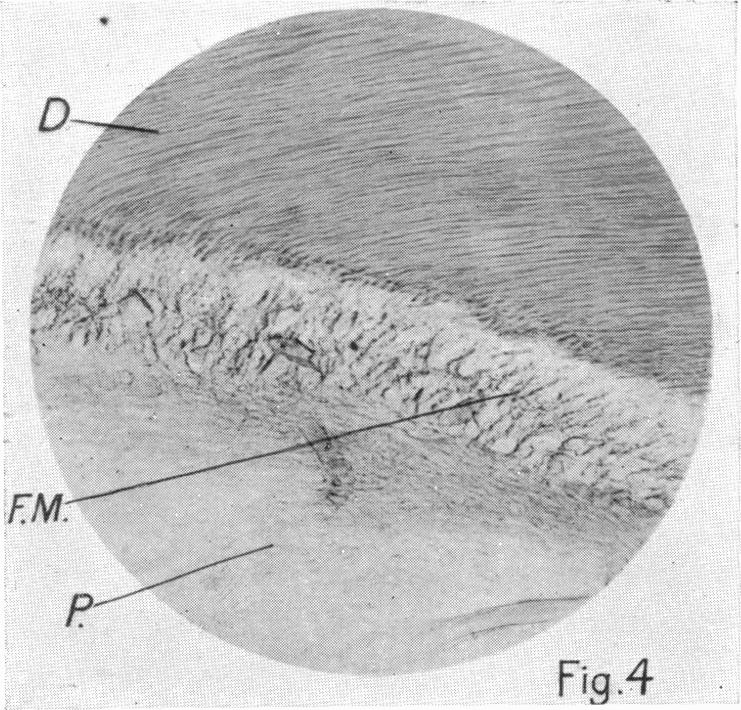 Fig.4