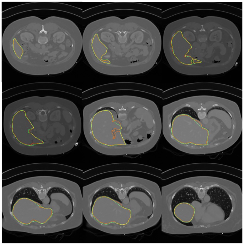 Fig 8