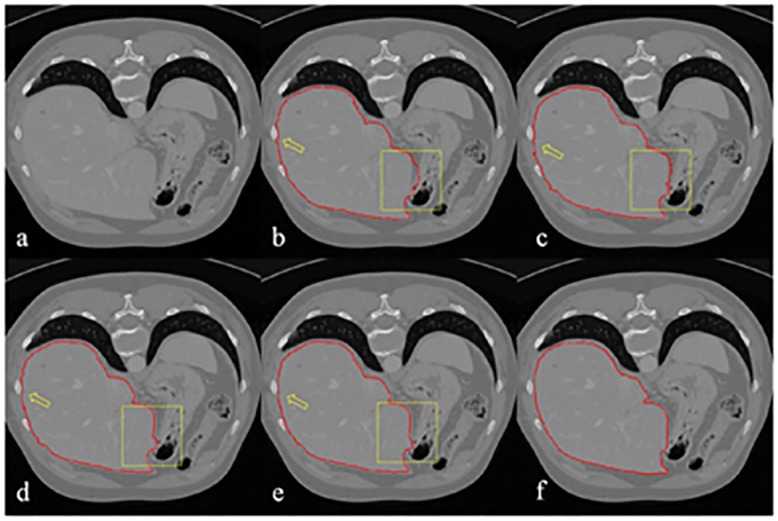 Fig 4